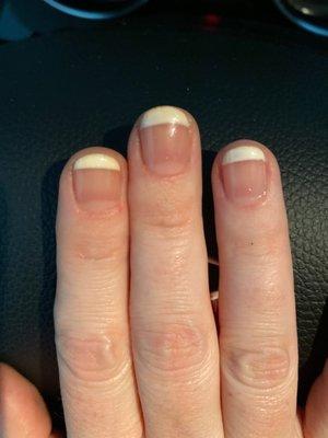 Poor gel French manicure: white of my manicure is cracking and yellowing.