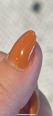 Dip all over my cuticles and a jagged nail. She filed this side of my cuticle raw as well. Painful.