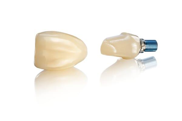 One of Our Dental Implants!