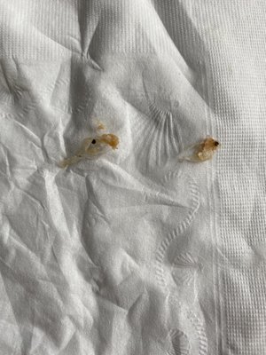 pieces of plastic found in breakfast sandwich