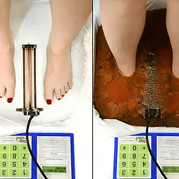 Ionic Footbath Before/After