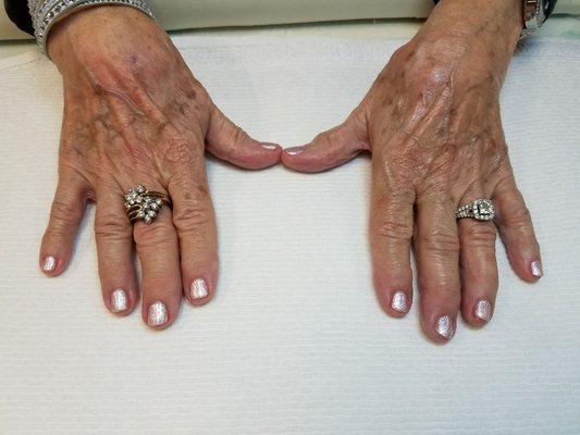 Even 80 years old can have nice nails even so my customer said she can't believe it !