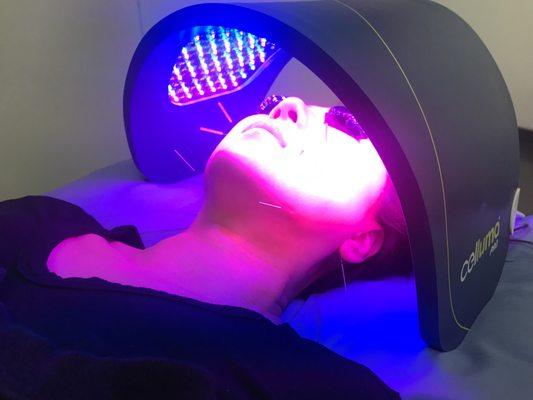 Glow! Cosmetic Facial Acupuncture