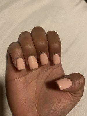 The shape looks different on each finger