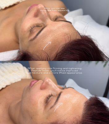 Firming Peptide Facial