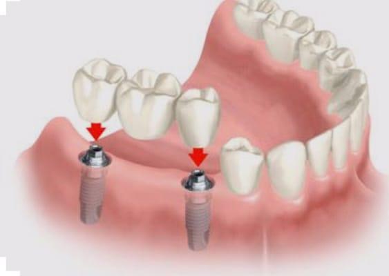 San Dimas Periodontics