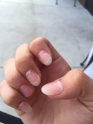 Just paid 40$ 5 days ago to get my full set and this is what happens 5 DAYS later, gel polish peeled off and all my nails lifted