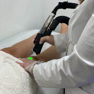 Full legs laser hair removal