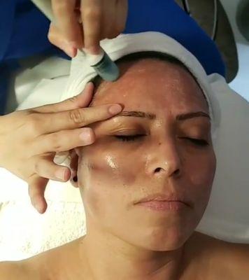 Microdermabrasion