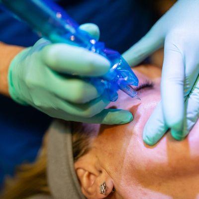 Lorrie Smith performing a microneedling treatment on a client