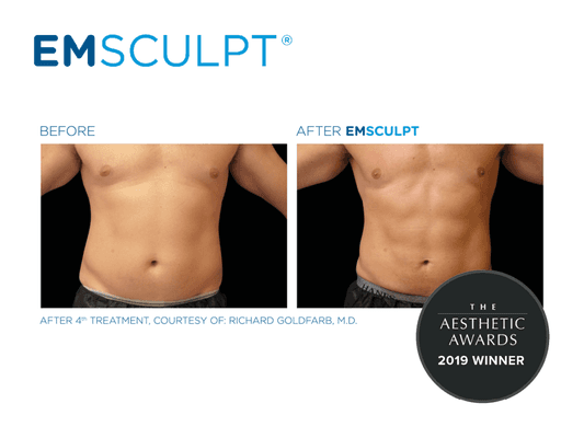 20,000 crunches in 30 minutes? Done. No surgery, no downtime, no sweat. EmSculpt in 4 treatments with results in less than 6 weeks!!