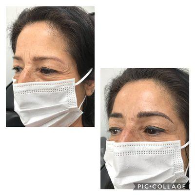 Microblading