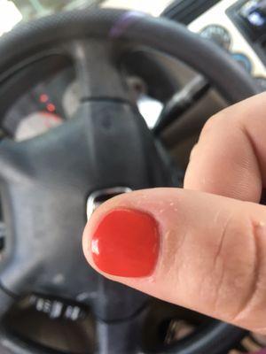 Leftover skin bad manicure