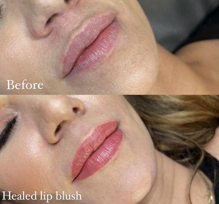 Before/After lip blush