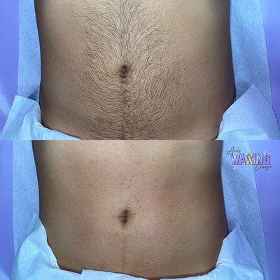 Men's stomach wax before and after