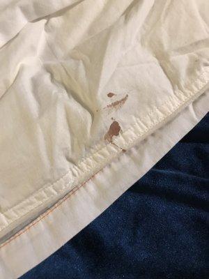 Bloodstain on the sheet.