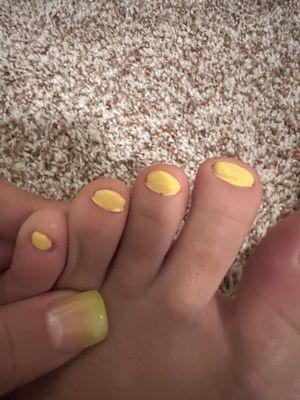 Horrible pedicure job even I could do better