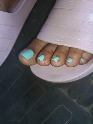 Results of my pedicure