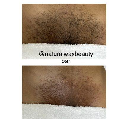 Before and after a Brazilian wax.