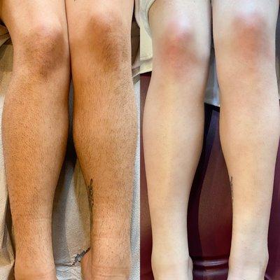 Leg Wax: Before & After