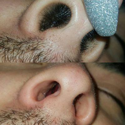 Nasal Hair Wax, Before and After