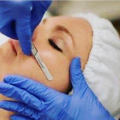 Dermaplaning is a non invasive procedure to take a skin dead cells. Glowing results. Book for free consultations