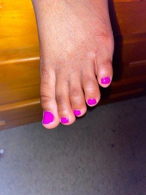 My Daughter Feet Done In Purple Polish