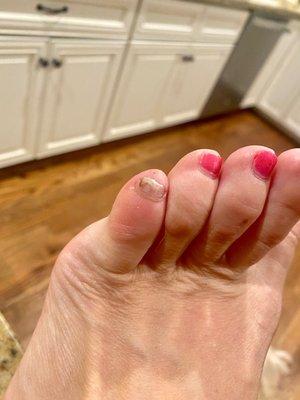 Today. Think it's fungus. The more I clip the toenail back, the whiter it gets.  How dare Bella Nails do this to my foot.