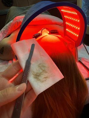 Dermaplane Facial