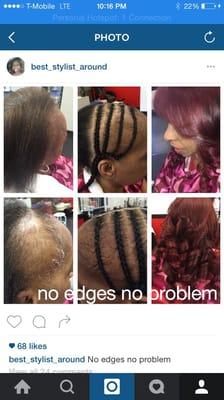 Do you need hair restoration? Are you balding and need help growing hair? Call life is beautiful beauty salon.