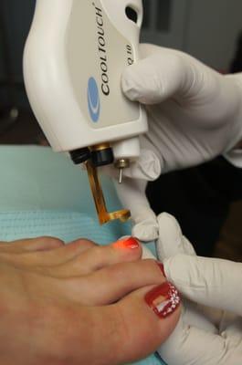 Dr. Nemrow has extensive expertise using Laser for Toenail Fungus treatment, and has successfully treated hundreds of patients.