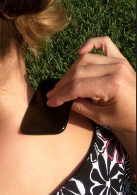 Gua sha on a 6 year old to treat a neck and shoulder injury.