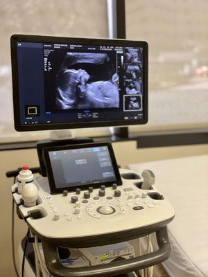 Look at this beauty of technological progress: proud to be offering you a 4D ultrasound imaging