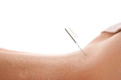 Acupuncture is a natural and gentle way to treat and promote your health.