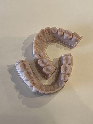 3D models of my teeth