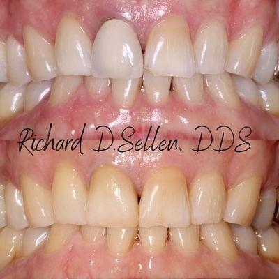 Richard D. Sellen, DDS