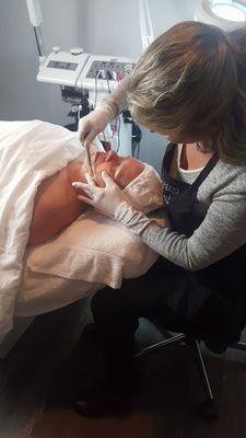 Dermaplaning