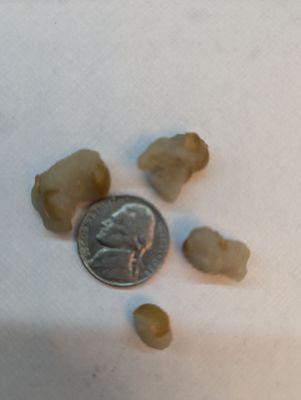 Rocks found in kettle corn