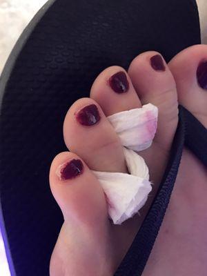 No idea how someone could look at that baby toe and think they did a satisfactory job.