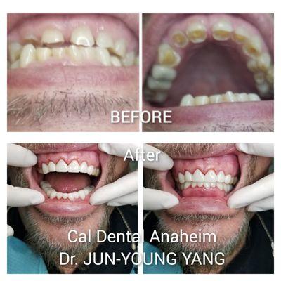 Cal Dental Anheim
3006 W LINCONLN AVE
ANAHEIM, CA 92801
(714) 828 0508