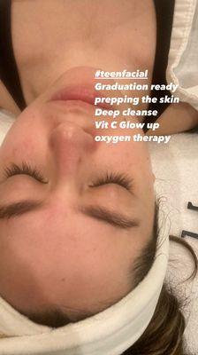 Deep pore Facials for teens