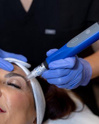 SkinPen: Our Favorite Microneedling Treatment