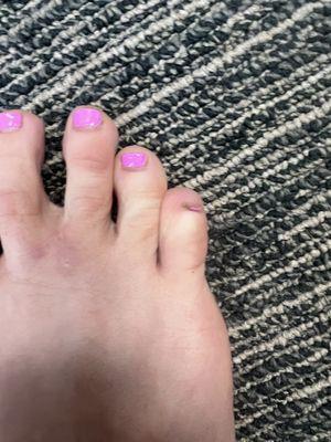 my pinky toe polish is already coming off! $171 completely wasted, down the hatchet...