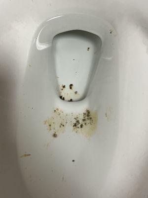 Mold/fungi growth stuck to bottom of toilets