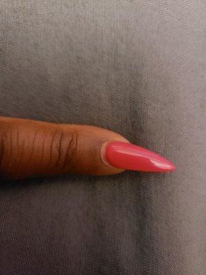 This is the "new nail" completely facing another direction than my finger.....x10!!!!