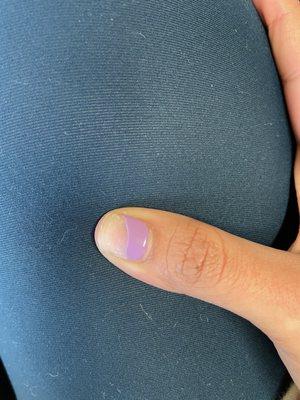 Chipped nail