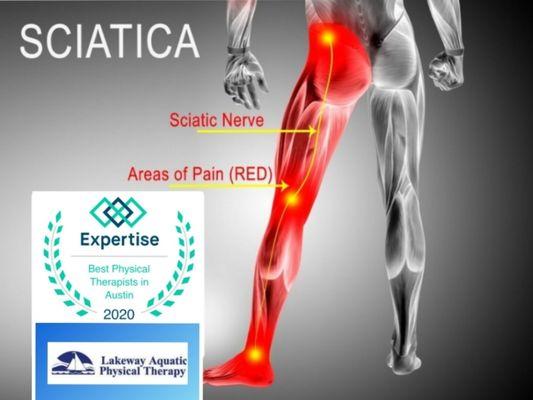 Sciatic Pain?...We can help...