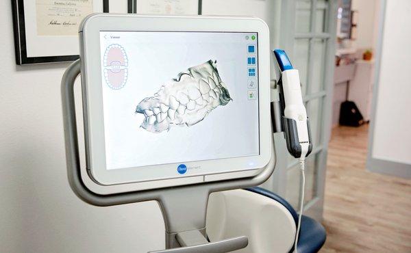 We have the Itero scanner for Invisalign. No more impressions!