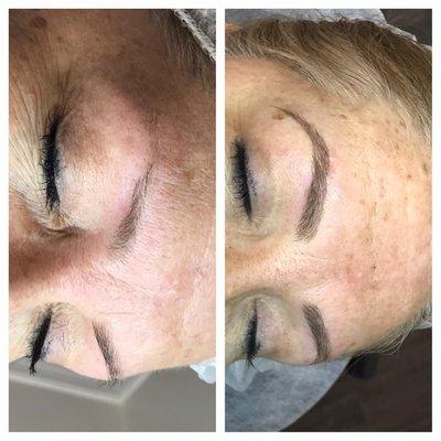 Before & After Microblading