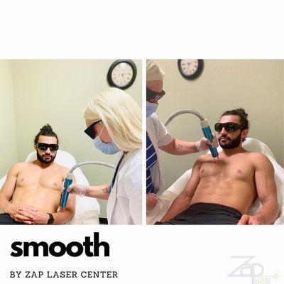 Ask about laser treatments for men!